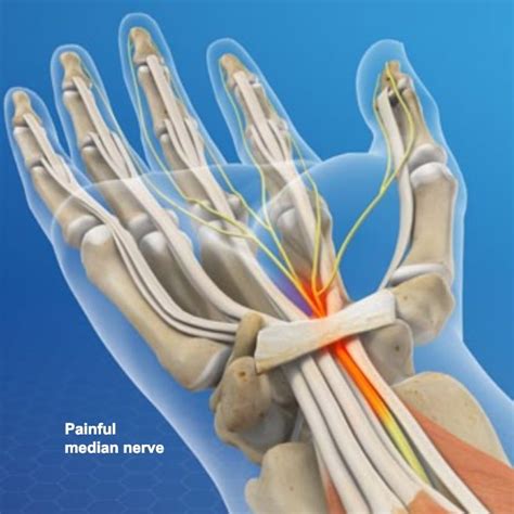 median nerve carpal tunnel exam